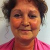 Anette Wind
